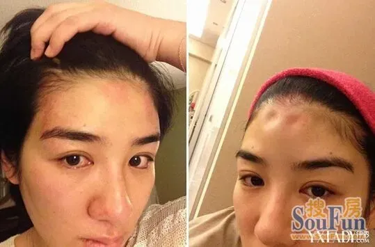 36岁黄奕晒家暴照 六段情史揭秘身世悲惨