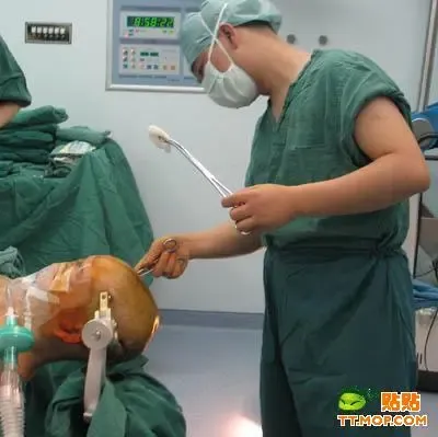 开颅手术绝对恐怖(胆小的劝你别看)