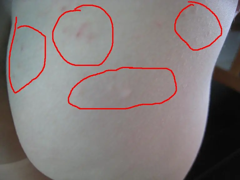 1号店卖的好奇纸尿裤过敏(非过敏体质)有图有真相,23楼有纸尿裤包